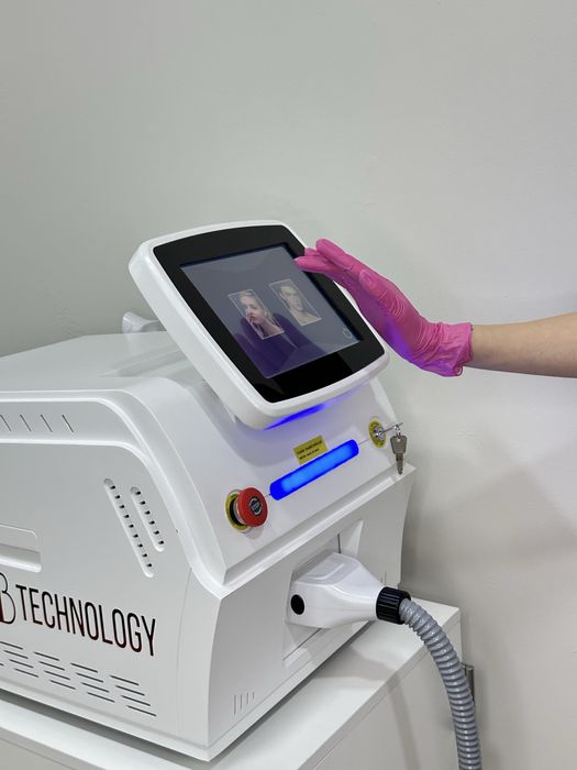 Диодная лазерная эпиляция