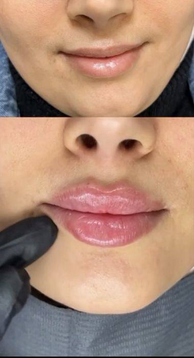 Muhabbat_cosmetolog Скидка хамма процедуралага