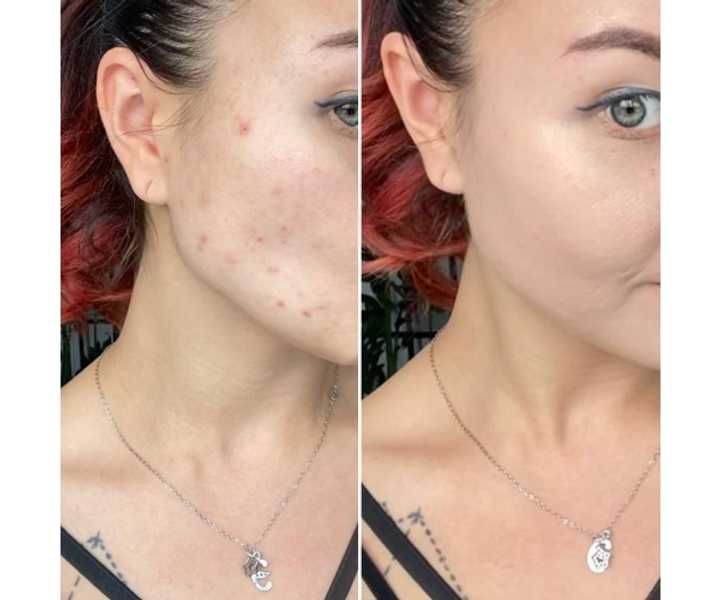 dr.hedison cushion за лице