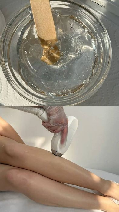 Косметология для женщин и мужчин  лазерная эпиляция