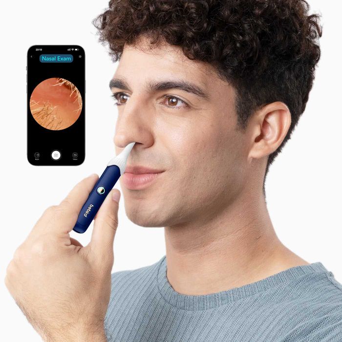 Bebird EarSight Plus – смарт комплект за почистване/преглед на уши,бял