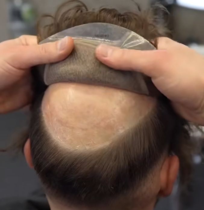 Мъжки системи от естествена коса