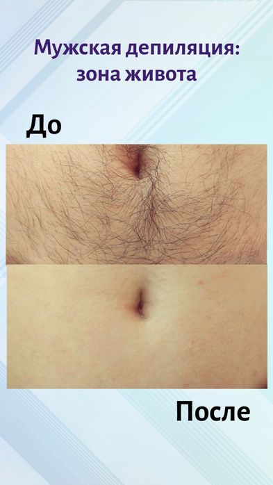 Депиляция воском для мужчин