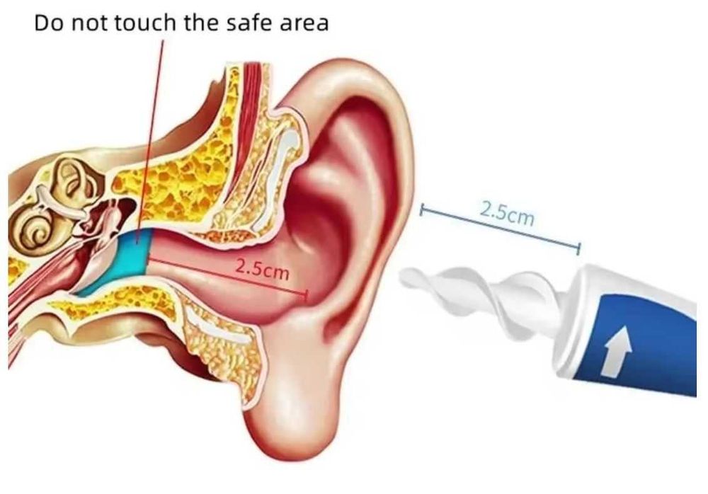 Уред за почистване на уши