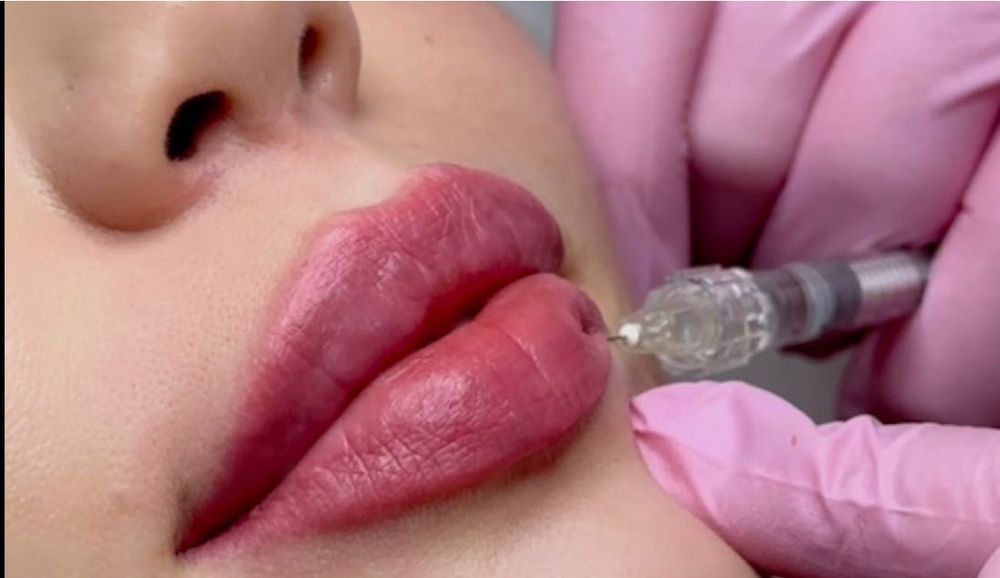 Филлер для губ по выгодным ценам.Арзон нархда лаб учун филлер