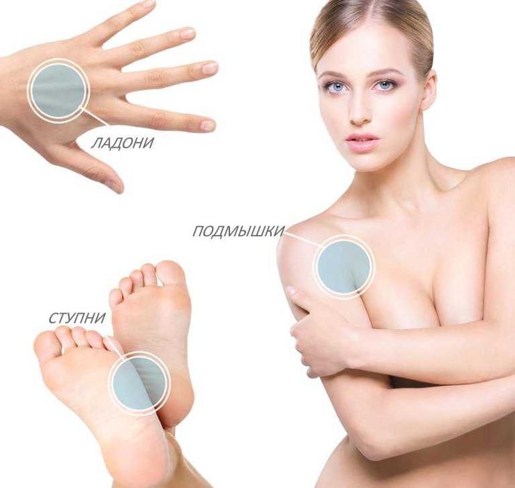 Лечение Гипергидроза. Ko'p terlashni davolash. Косметолог.