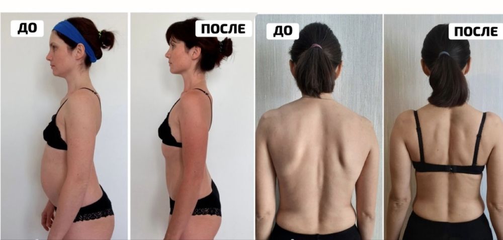 Коррекция фигуры