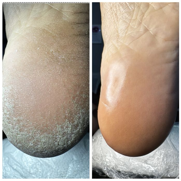 Мужской смарт педикюр