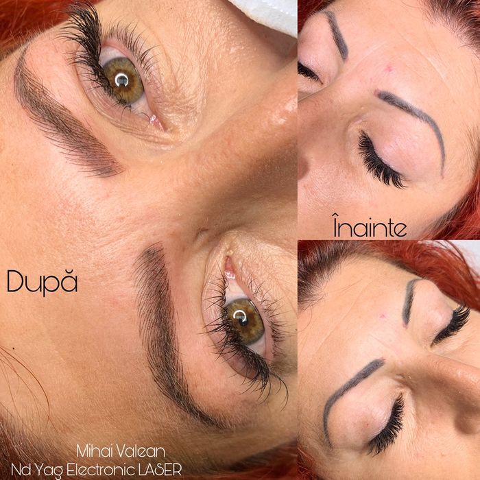 Tatuaj cosmetic , Microblading si Eliminare Tatuaje cu Laser