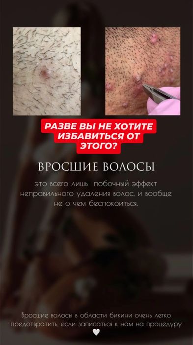 Шугаринг для мужчин