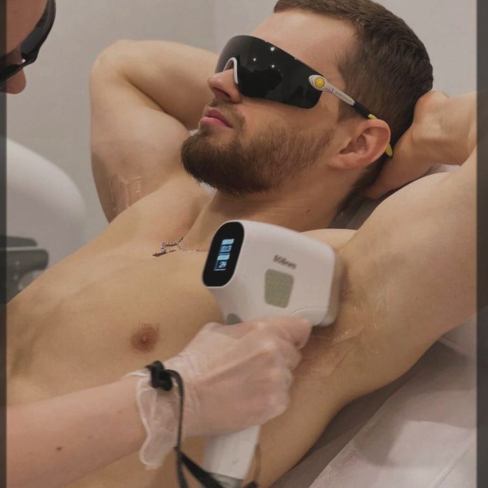 Депиляция Эпиляция лазерная маникюр педикюр