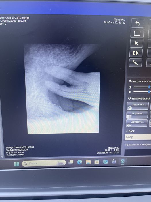 Продам зуб мудрости. Зуб целый с корнями, подойдет для практики.