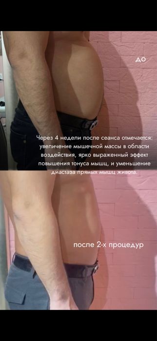 Аппарат для похудения Jordi Shape