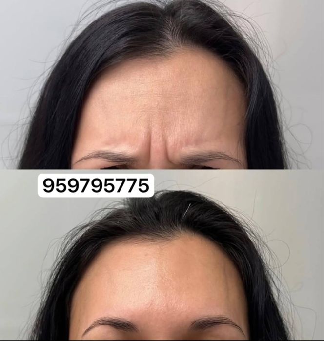 Kosmetolog 5yilik tajribaga ega pirafisanal