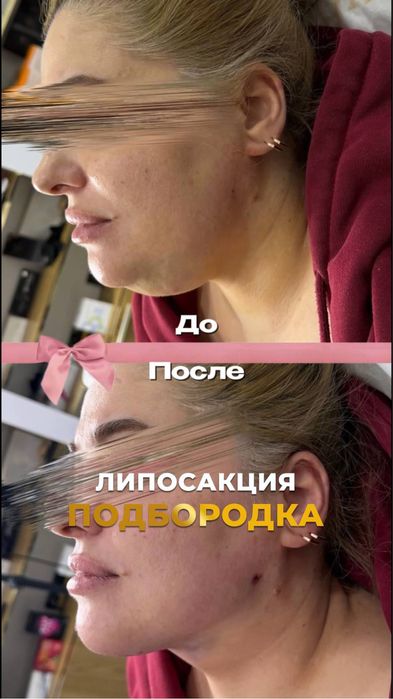 Услуги косметолога