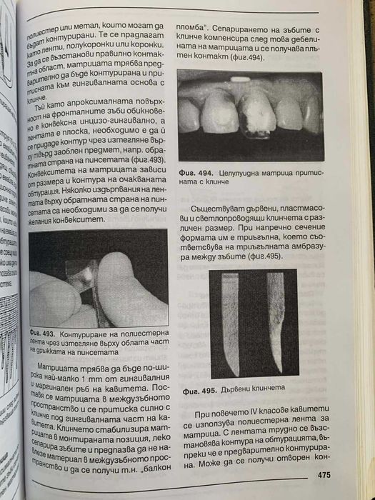 Кариесология и оперативно зъболечение