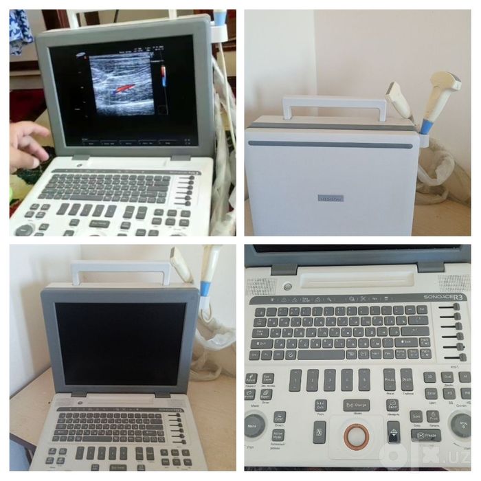 Портатив УЗИ Samsung Medison SonoAce R3 2015 сотилади,