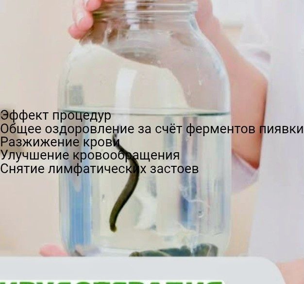 Лечение пиявками Суликпен емдеу