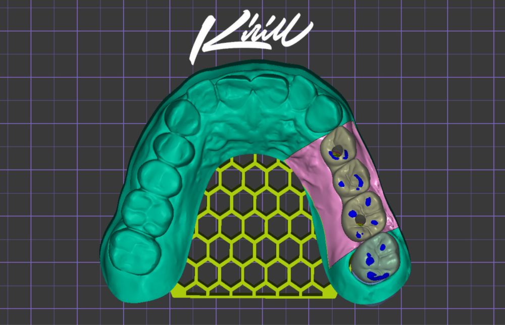 Моделирование зубов (exocad/blender)