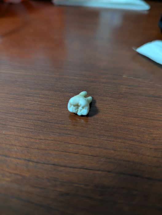 Зуб мудрости в отличном состоянии