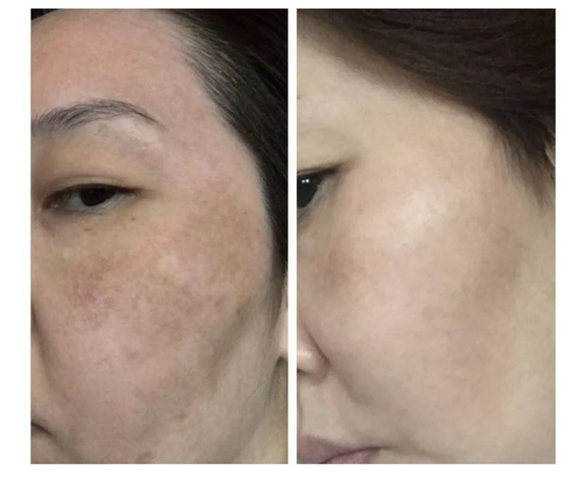 Stop pigment крем против пигментации