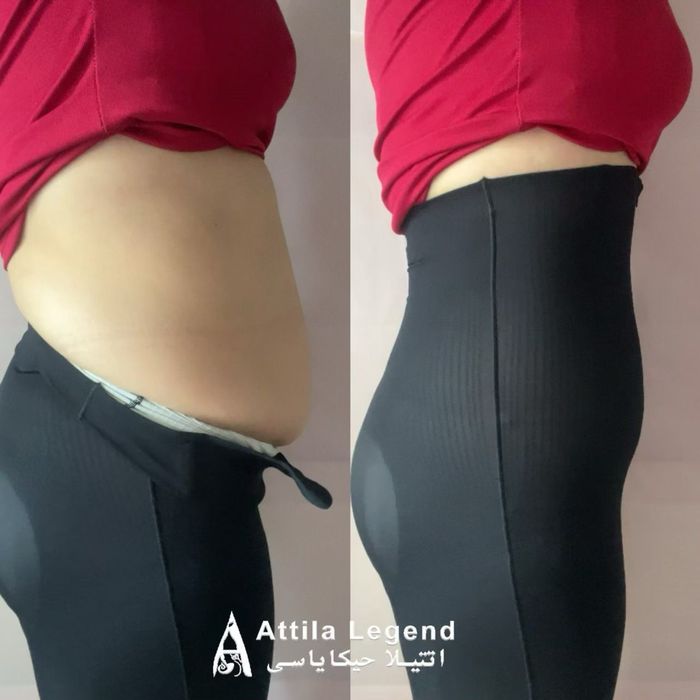 Арықтататын қйім