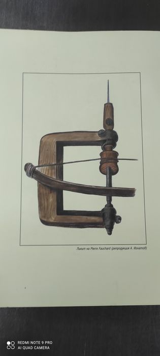 Изпиляване на зъбите за керамични и металокерамични коронки