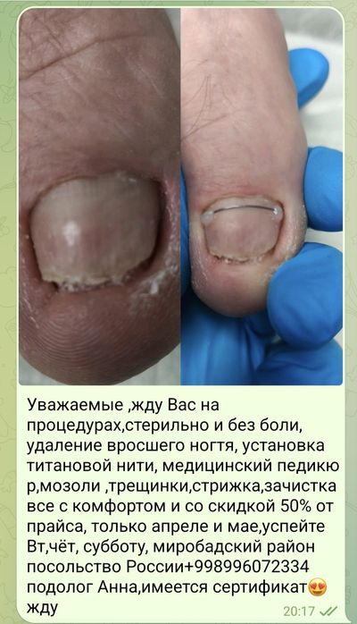 Педикюр для всех