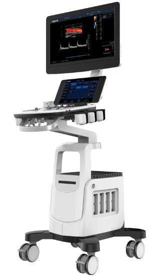 УЗИ аппарат Chison Cbit 6