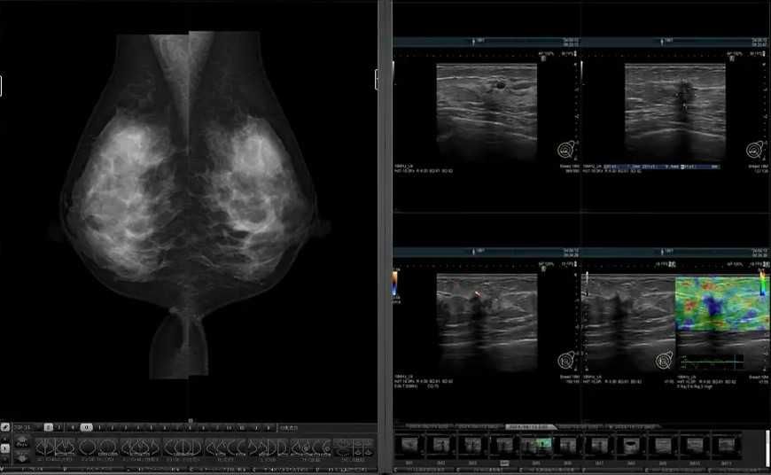 Quadro radiforce RTX 4000 EIZO MED-XN92 Medical за медицинска диагностика