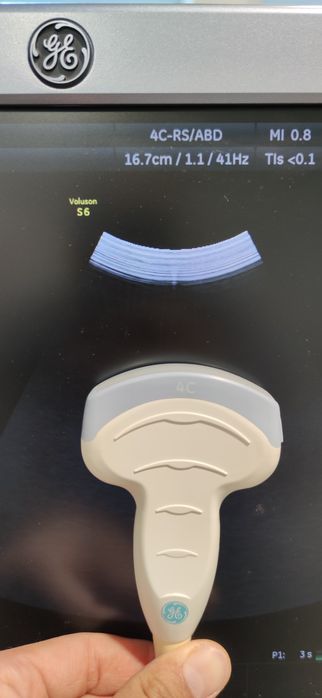 Датчик узи GE C2-4 конвексный