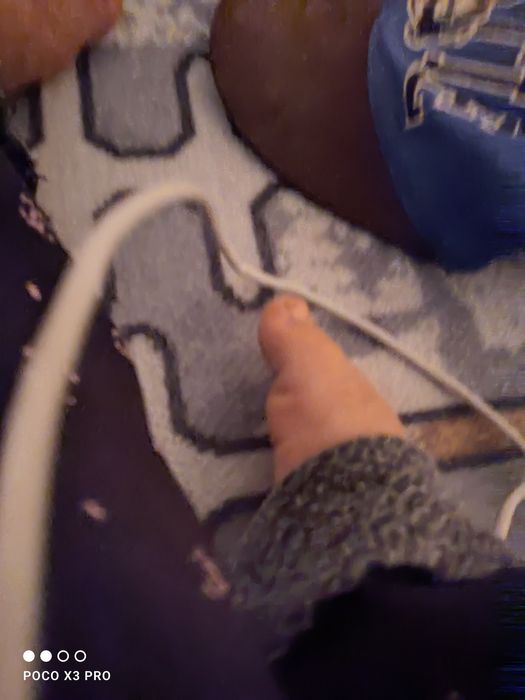 Redmi note 12 pro kafolati bilan