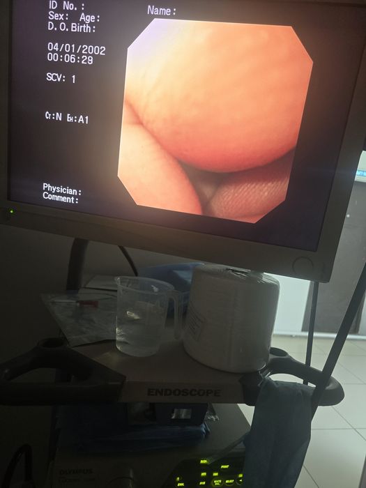 ФГДС. Гастроскоп Олимпус 260 продам