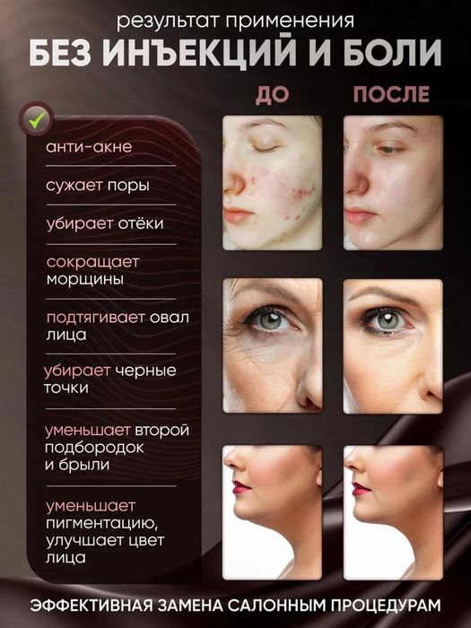 Микротоковый массажер для лица 5 в 1  / Юз учун кўп функцияли массажер