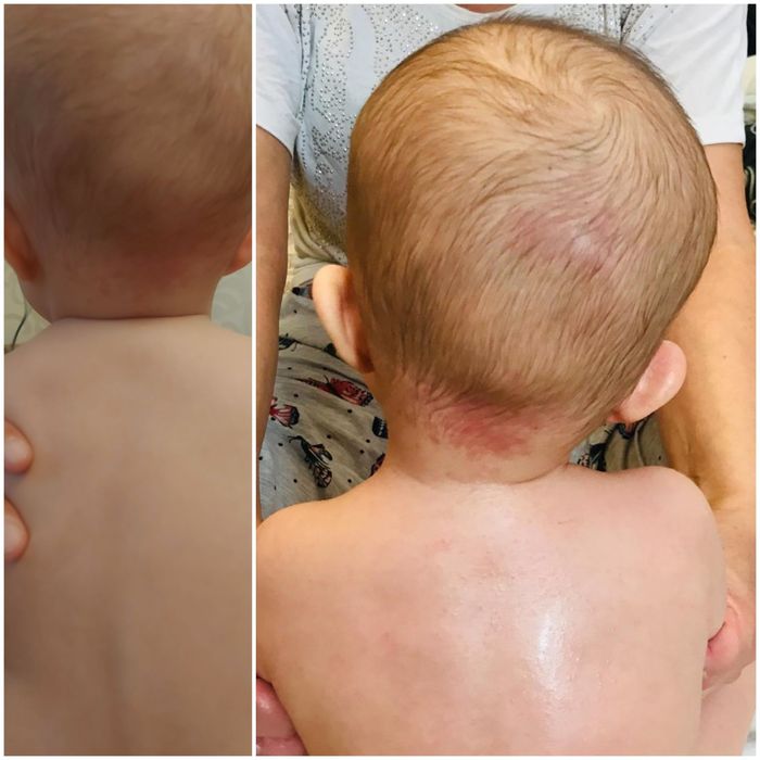 Детский массажист  на дому