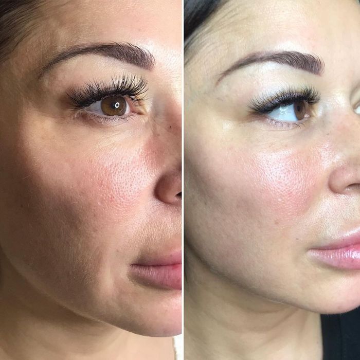 Косметология курс очилди