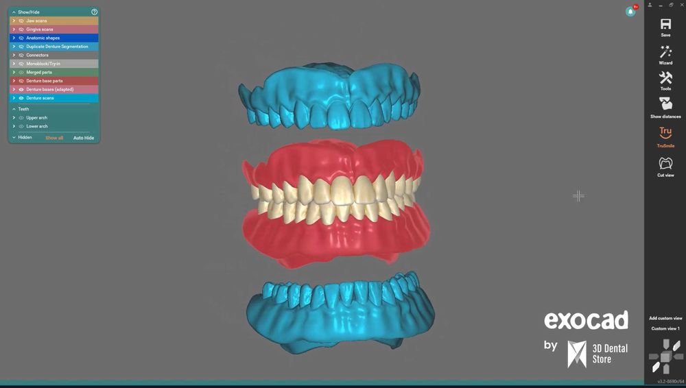 EXOCAD 3.3 Chemnitz + PartialCAD ​​3.3 + ExoPlan 3.1 + B4D iBar