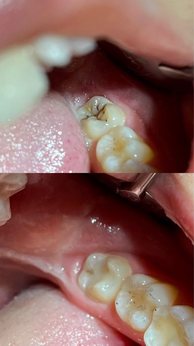 Евтини стоматологични услуги Пловдив