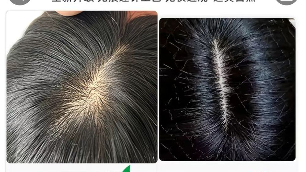 Tabiy va siffatli makushka Narashkalar bor