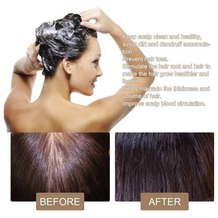 Оризов сапун против косопад