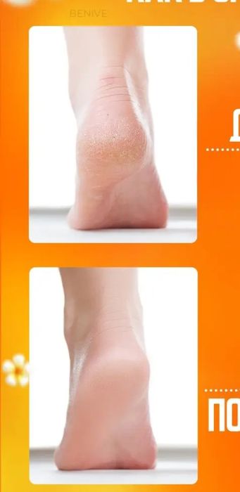 Педикюрный набор