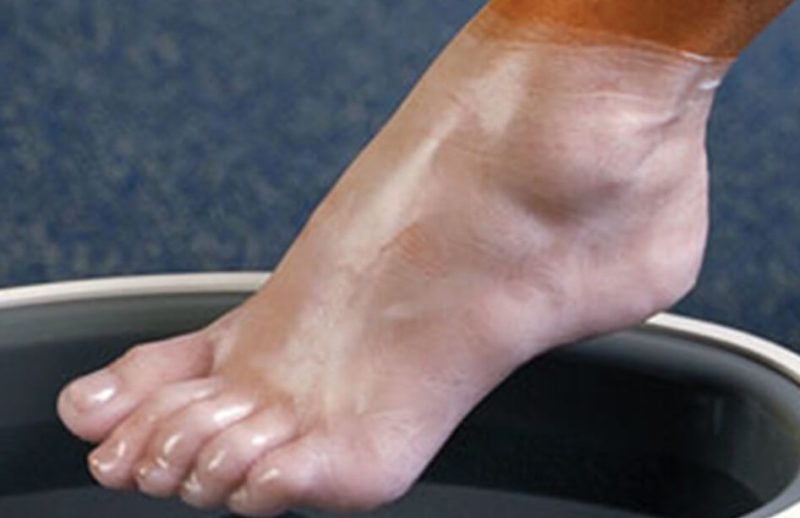 Парафин Косметический Парафинотерапия