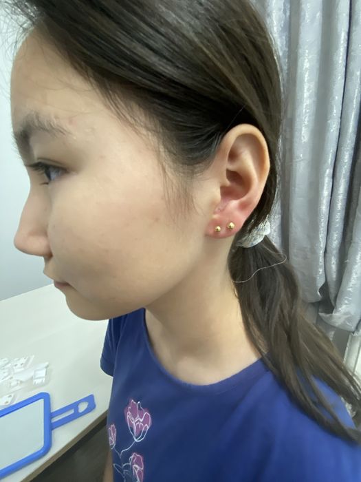 Прокол ушей стадекс