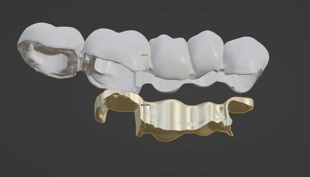 CAD/CAM дизайн |Корони, мостове, барове| 3Shape | Blender for Dental |