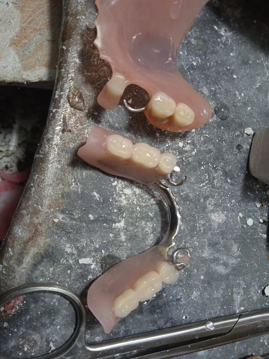Продам протезы съёмные