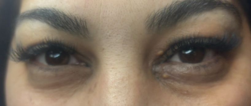 Extensi gene 1-3D soft si mega volume