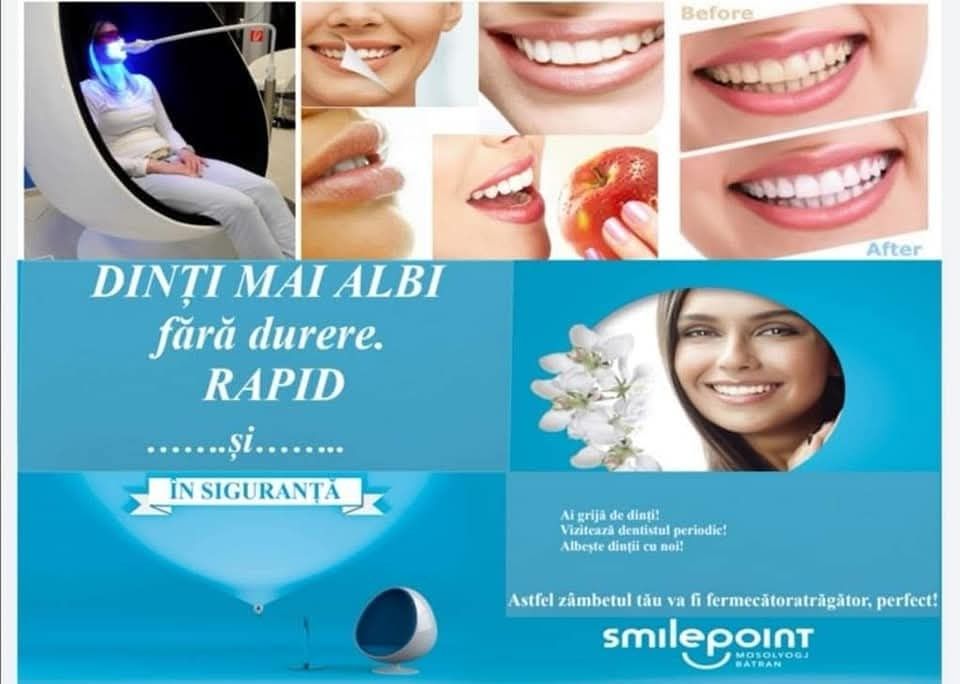 Aparat albire dinti