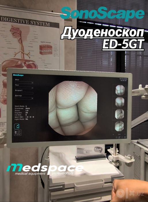 Видеодуоденоскоп