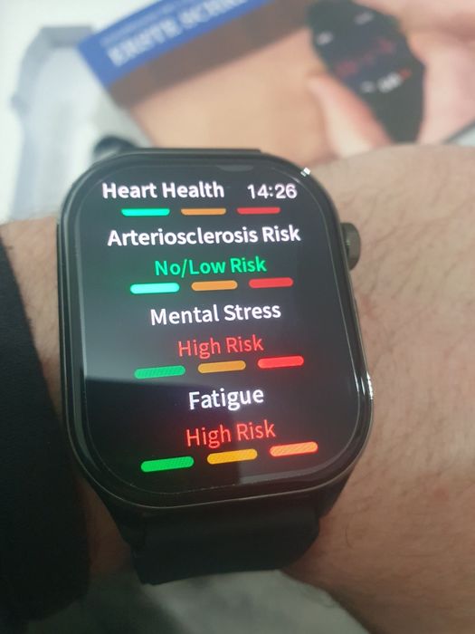 Смарт ЕКГ часовник Knauermann Pro 3 ECG