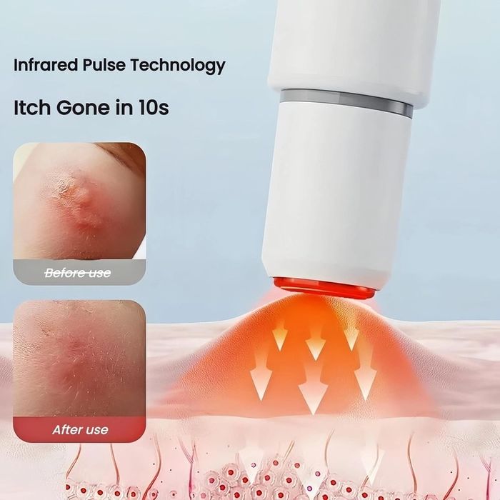 Бутилка за облекчаване на сърбеж при насекоми